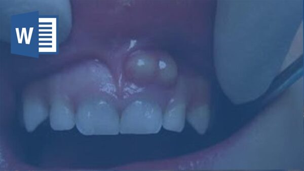 تحقیق کیست دندان