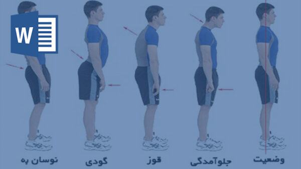 تحقیق رایگان درمورد قوز کمر